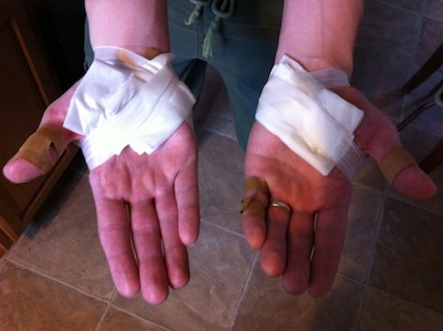 Fred's hands, with security patches